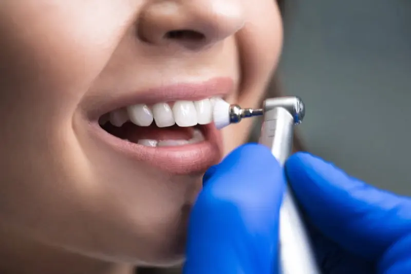 Patient smiling during a professional cleaning