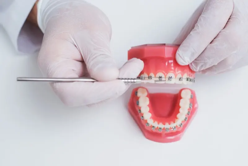 Orthodontic model with braces